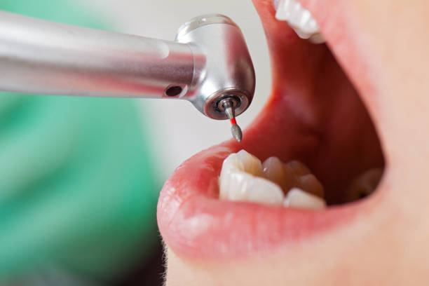 Best Same-Day Emergency Dentist in Timpson, TX